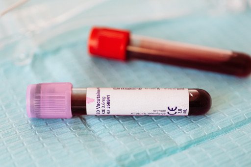 Comprehensive Guide to Conducting a Blood Count Test at Home